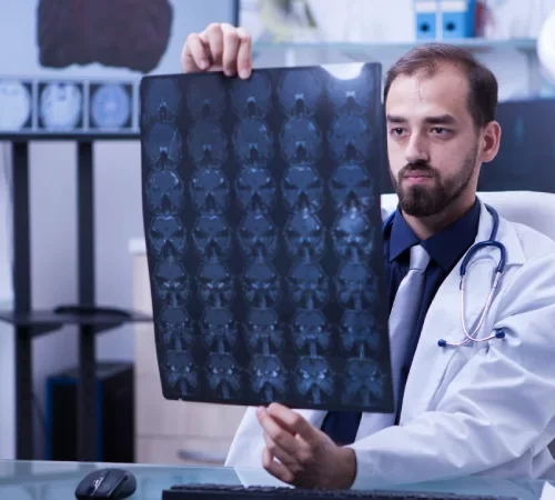 Koroner Bt Anjiyografi Ameliyat Sonrası Komplikasyonlar anjiyo sonucu inceleyen doktor