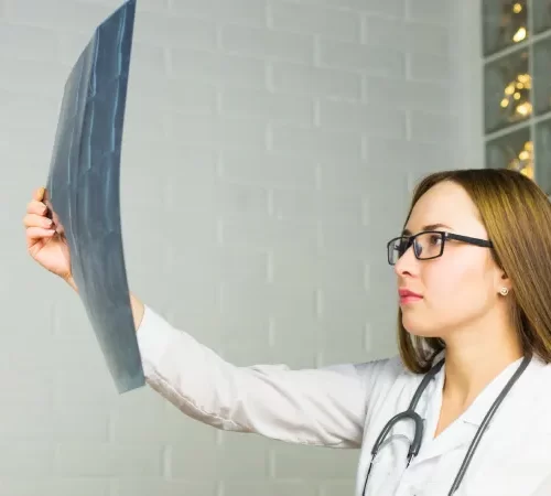 Beyin MR ile Hangi Hastalıklar Teşhis Edilir? mr röntgeni inceleyen doktor