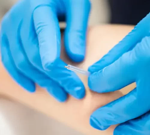 kuru-igneleme-acitir-mi-m kuru iğneleme acıtır mı kuru iğne yapılan hasta