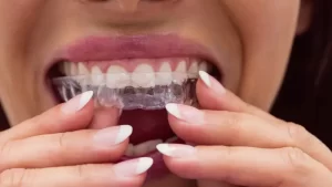 invisalign şeffaf diş teli tedavisi gören kadın