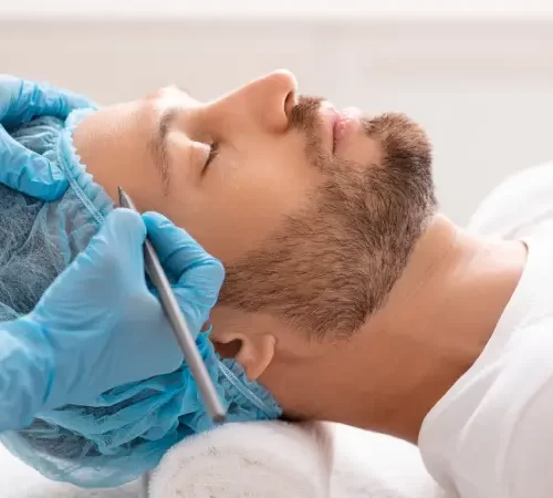 altin-igne-hakkinda-merak-edilenler-m Altın İğne Hakkında Merak Edilenler altın iğne lazer yapılan erkek hasta