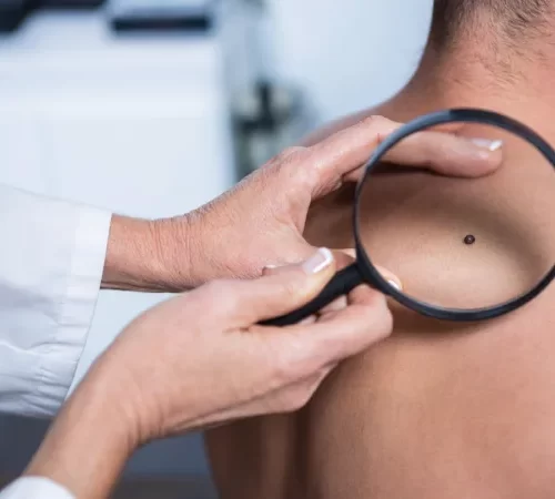 ben-aldirma-m cildiye ben aldırma muayenesi olan hasta