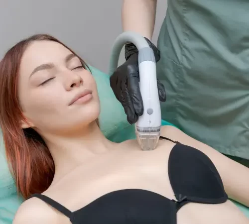 hifu-oncesi-yapilmasi-gerekenler-m hifu öncesi yapılması gerekenler hifu uygulanan kadın