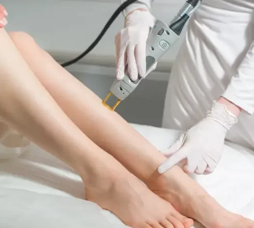 yuksek-yogunluklu-lazer-hilterapi-m yüksek yoğunluklu lazer tedavisi gören kadın