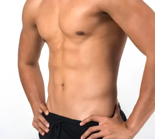 Gynecomastia