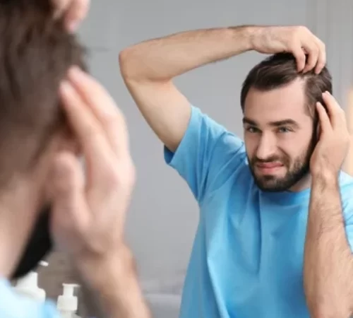 hair transplant