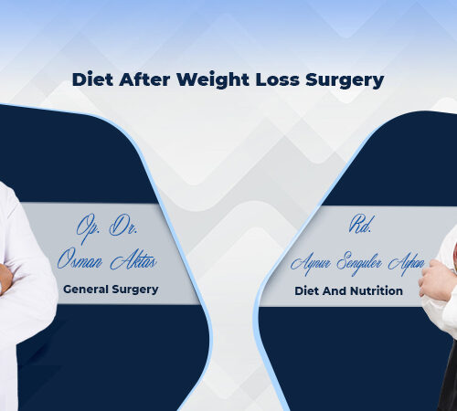 DIET AFTER WEIGHT LOSS Surgery