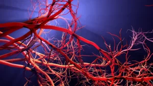 Arteriovenöz Malformasyon (AVM) Nedir? Tedavisi - Beyin damarları