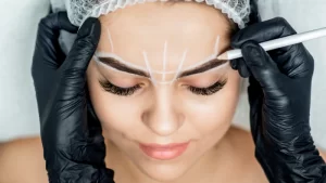 Brow Lifting