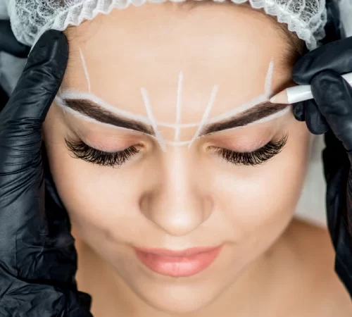 Brow Lifting