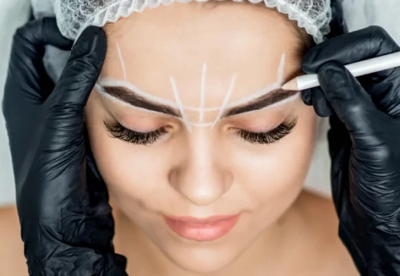 Brow Lifting