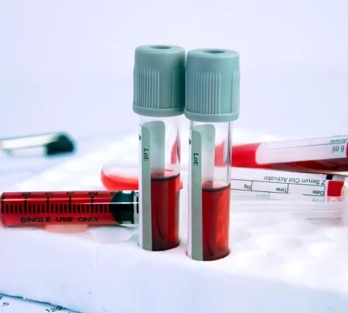 Kan Testleri (Kan Tahlilleri) Nelerdir?- kan tüpleri