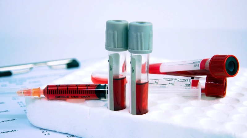 Kan Testleri (Kan Tahlilleri) Nelerdir?- kan tüpleri