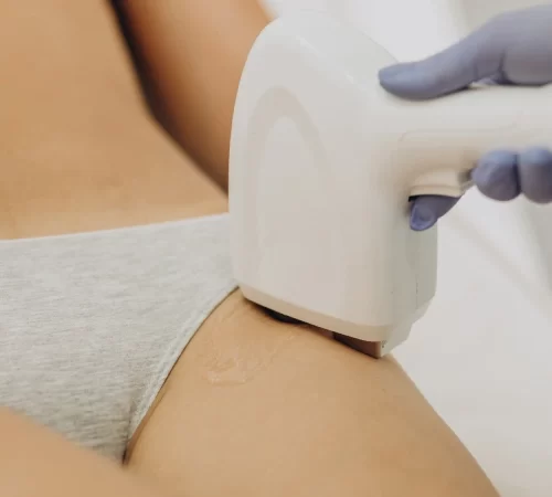 Genital Bölge Lazer Epilasyon - Zararlı Mı? - genital bölge ve lazer