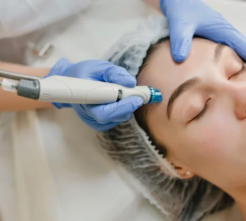 Hydrafacial cilt bakımı- cilt bakımı yaptıran kadın