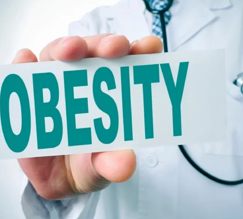 Obezite Ameliyatları: Hangi Hastalara Yapılır?- obez yazısı tutan doktor eli