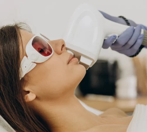 Yüz İçin Lazer Epilasyon - yüzüne lazer yaptıran kadın
