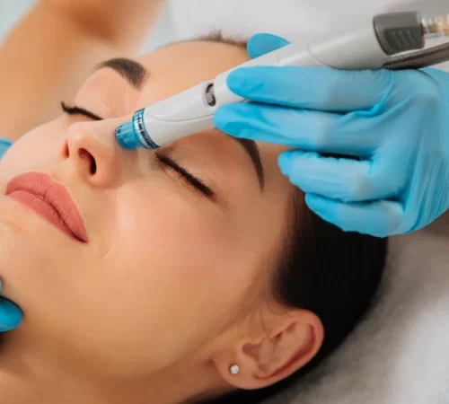 Hydrafacial Başlıkları Ne İşe Yarar? - hydrafacial yaptıran bir kadın