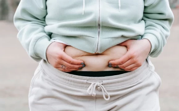 Obezite Nedenleri- obez ve göbeğini tutan kadın