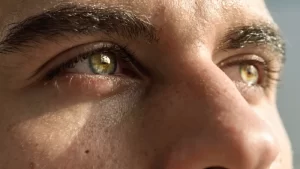 Sarı Nokta Etkili Tedavisi- sarı nokta hastalığına sahip göz