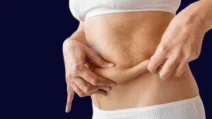 preventing sagging skin after weight loss surgery