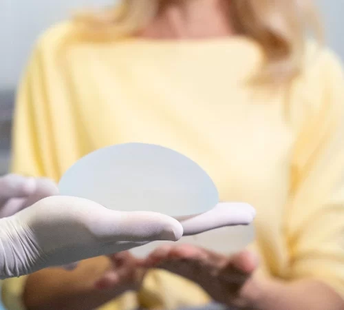 breast implant removal guide