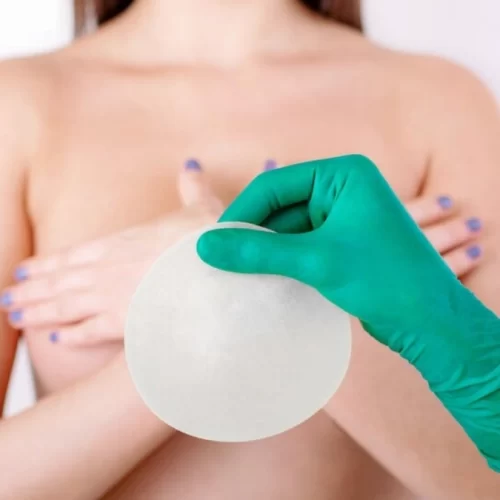 Breast Implant Removal in Turkey