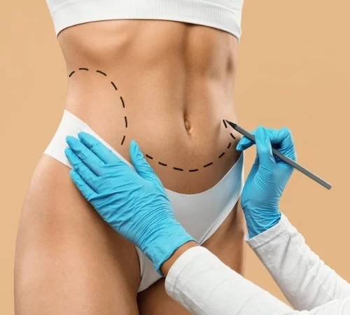 mini tummy tuck in turkey