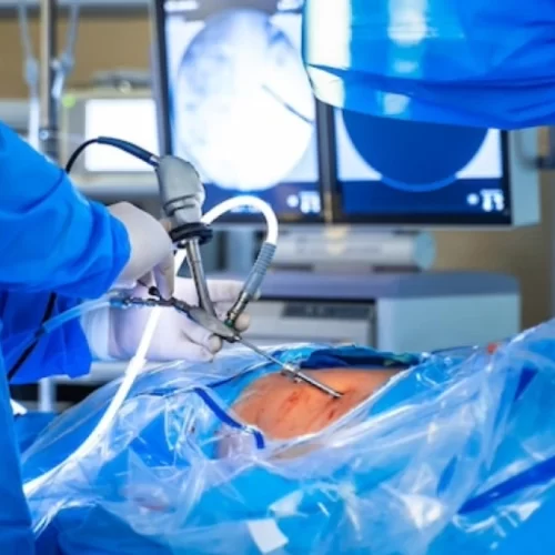 laparoscopic surgery for endometrial cancer