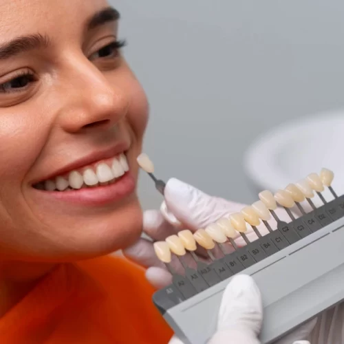 Dental Veneers in Turkey