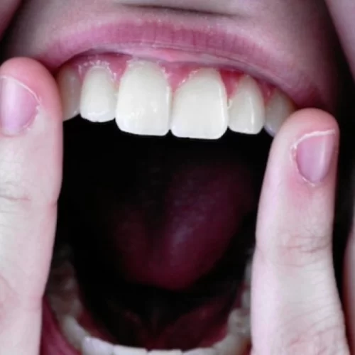 Oral Cancer Treatment in Turkey