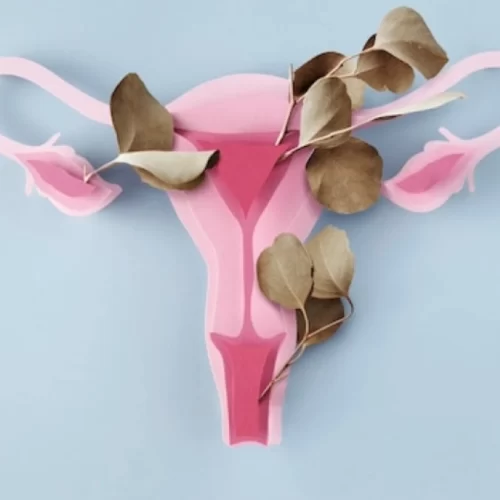 Polycystic Ovary Syndrome