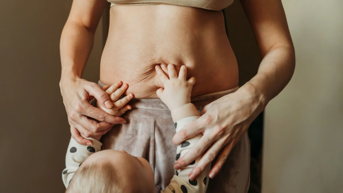 Mommy Makeover in der Türkei