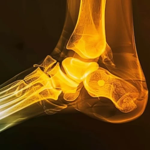 Ankle Ligament Reconstruction in Turkey