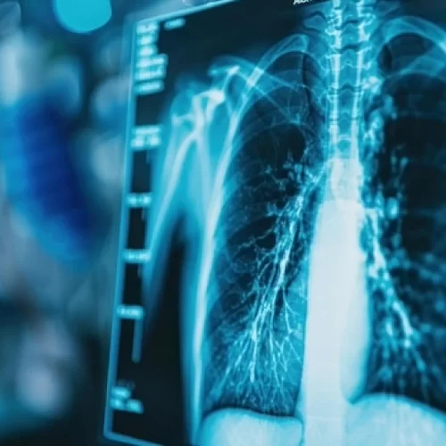 Radiology in Turkey
