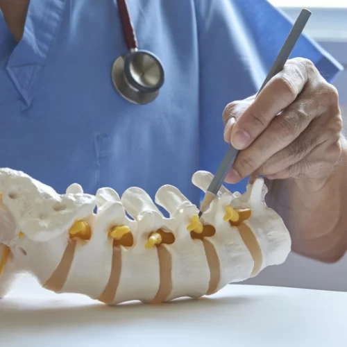 Wirbelsäulenchirurgie-in-der-Türkei Wirbelsäulenchirurgie in der Türkei