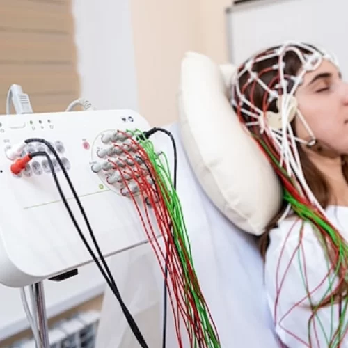 TMS Treatment in Turkey