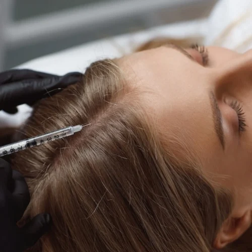 PRP Hair Treatment in Turkey