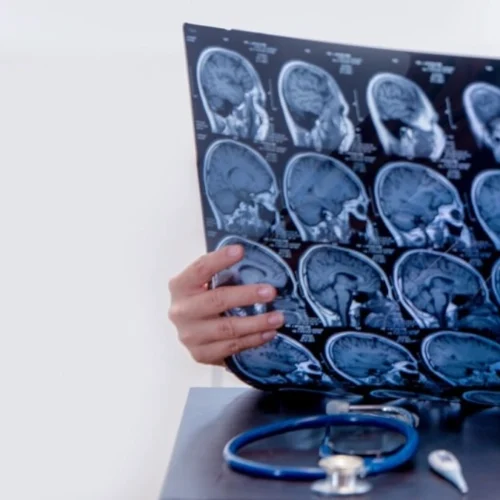 Stroke Treatment in Turkey