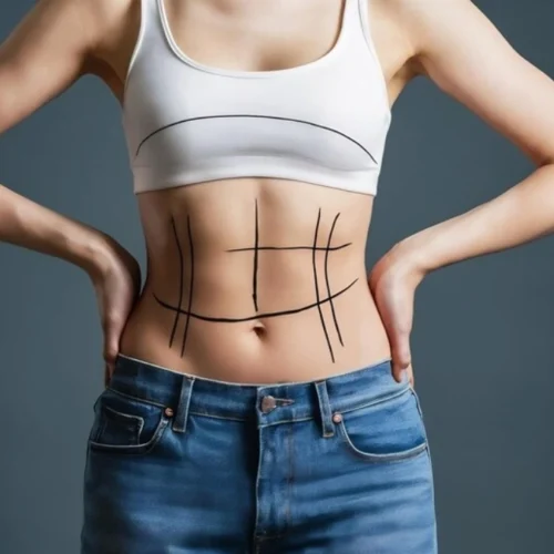Tummy Tuck Myths vs. Facts