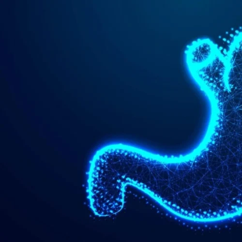 Duodenal Switch Surgery in Turkey