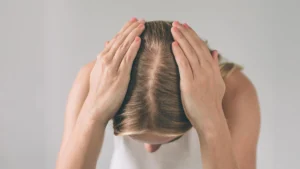 نکات مهم قبل از انجام کاشت مو