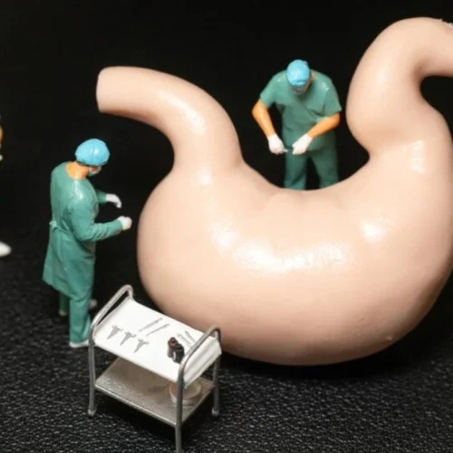 Stomach Stapling Surgery in Turkey