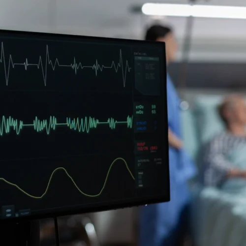 Echocardiogram in Turkey