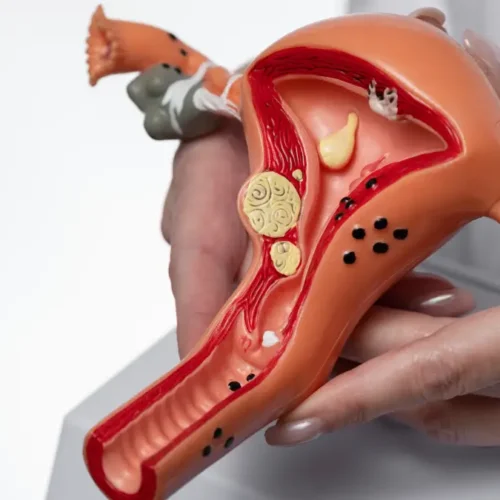 servikal-yetmezlik-rahim-agzi-yetersizligi-nedir Servikal Yetmezlik