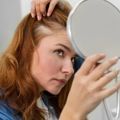 Türkiye'de Kadınlarda Saç Ekimi