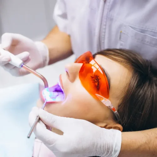 turkiyede-dis-beyazlatma-bleaching-neden-tercih-ediliyor-g Türkiye’de Diş Beyazlatma