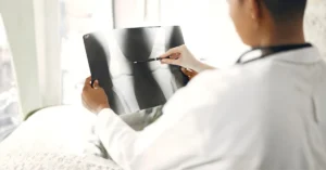 پروتز تعویضی Revision