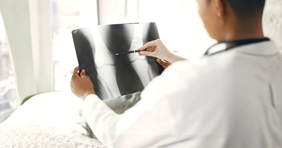 پروتز تعویضی Revision