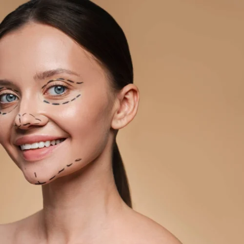 Deep Plane Facelift Surgery in Istanbul